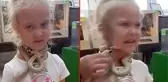Önce her şey sakindi! Bir anda sinirlenen yılan küçük kızın suratını ısırdı
