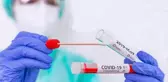 Aşısızlar, PCR test laboratuvarlarının yükünü artırıyor