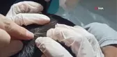 5 yaşındaki çocuğun kafasına kene yapıştı