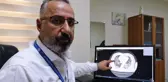 Aşısız hastaların akciğer tomografisini paylaşarak uyardı