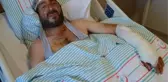 AYI SALDIRISINA UĞRAYAN KESER: YALNIZ PENÇE VURMADI, ELİMİ DE PARÇALADI