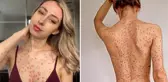 Vücudu hakkındaki sözlerden sıkılan genç kız, paylaştığı bikinili fotoğraflarla eleştirilere meydan okudu