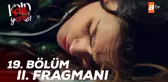 Kalp Yarası 19. Bölüm 2. Fragmanı | Ölüyorum