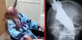 Sarhoş koca, gözüne bıçak sapladığı eşini kör etti