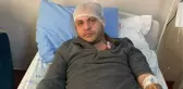 HASTA YAKINI, MERMER AKSESUARLA DOKTORU BAŞINDAN YARALADI