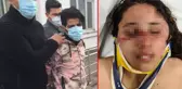 Eşinin üzerinde sigara söndürüp bıçakla yaraladığı 7 aylık hamile kadın, beyin kanaması geçirdi