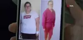 Mide baypass ameliyatı oldu, 177 kilodan 59 kiloya düştü
