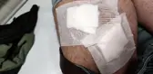 Tarladaki çiftçi köpeklerin saldırısına uğradı