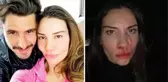 Özer Hurmacı'nın eşi Mihriban Hurmacı, şiddet anını anlattı: Çocuklar, bana tekme atan babalarının bacağına sarıldı