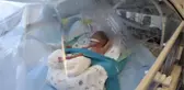 5,5 AYLIK DOĞAN YAVUZ SELİM BEBEĞE KÖK HÜCRE TEDAVİSİ