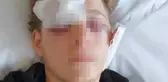 Arkadaşının silahla oynarken şakağından vurduğu genç görme yetisini kaybetti