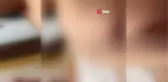 Son dakika haberleri! Sokak köpeklerinin saldırısına uğrayan kız çocuğu ölümden döndü
