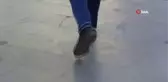 Dar ayakkabı tercihi düztaban ve mantar enfeksiyonlarına neden olabiliyor