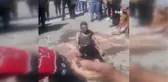 Meydanda kendini yaktı, hastanelik oldu