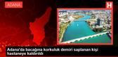 Son Dakika | Adana'da bacağına korkuluk demiri saplanan kişi hastaneye kaldırıldı