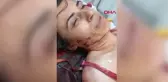 Eski elti dehşeti yaşattı! 17 kez bıçaklayıp üzerine kaynar su döktü