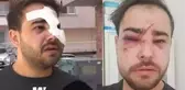 İkinci Onur Şener vakası! İstek parçayı çalmadı diye yüzünde bira şişesi kırdılar