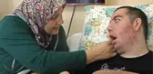 10 yıldan bu yana göz kapaklarını tek bir kere bile kırpmadı: Artık gözlerinden kan geliyor