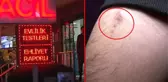 Hem sağlığı hem de 700 bin lirası gitti! Böbrek ağrısıyla gittiği tıp merkezinde morfin bağımlısı oldu