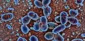 Strep A bakterisi: Belirtileri neler?