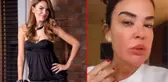 Ünlü sunucu Özlem Yıldız'ın son iki haftada başına gelmeyen kalmadı! Yaşadıkları nedeniyle yüzü şişti