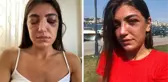 Manken Gizem Akbaş'ın darp edilmesine ilişkin davada sanığa 1 yıl hapis talebi