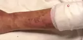 Lavabo açıcı bomba gibi patladı! Kıyafetleri pul pul dökülen genç kadın acılar içinde hastaneye koştu
