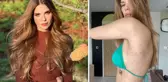Güzel oyuncu Larissa Gacemer, gül hastalığına yakalandı