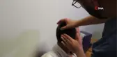 İlk kez biyonik kulak ile duymaya başladılar