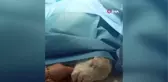 Ters doğan kuzu Türkiye'de ilk defa yapılan bir ameliyatla tedavi oldu
