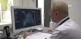 Kalça çıkıklığında erken teşhis tedaviyi kolaylaştırıyor