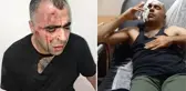 Belediye başkanının korumalarının tekme tokat dövdüğü gazeteci Sinan Aygül'den ilk sözler: Bu işin peşini bırakmayacağım