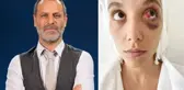 Şiddet davasında yeni gelişme! Ozan Güven cephesi kendi photoshop iddiasını boşa çıkardı: Araştırılmasın