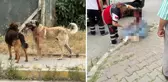 İstanbul'da köpek saldırısına uğrayan kadın gözünü kaybetti
