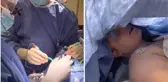 Beyin ameliyatı sırasında uyanık olan hasta doktorlara mini konser verdi