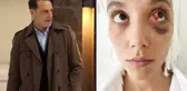Deniz Bulutsuz ve Ozan Güven arasındaki şiddet davasında adli tıp raporu mahkemeye ulaştı