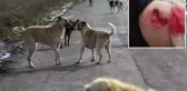 Antalya'da başıboş köpek dehşeti! Küçük çocuğunun baldırını ısırıp etini kopardılar