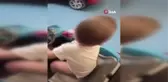 10 Metrelik Sondaj Kuyusundan Kurtarılan Minik Yamaç Sağlığına Kavuştu