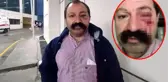 Sosyal medya fenomeni, ev sahibi tarafından darp edildi: Öyle bir vurdu ki kendime gelemedim