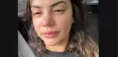 Şarkıcı Ece Ronay, Eski Eşi Tarafından Şiddete Uğradığını Açıkladı