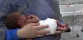 Prematüre bebekler yaşam mücadelesini Özel Ümit Hastanesinde kazanıyor