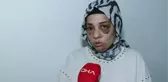 Bağcılar'da Şiddet Mağduru Kadın Devletten Yardım Bekliyor