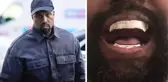 Kanye West, 850 bin dolarlık titanyum protez diş taktırdı