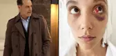 Eski sevgilisini darp ettiği iddiasıyla hapsi istenen Ozan Güven'in davasında Adli Tıp Kurumu raporu hazırlandı