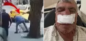 Çıkan tartışmada taksici, yayaya yumruk atarak burnunu kırdı
