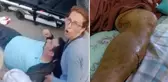 Pitbull saldırısına uğrayan genç adamın bacağına 28 dikiş atıldı! 