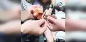 Mardin'de piknik yapan kız çocuğunun parmağına olta iğnesi battı