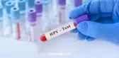 HPV aşısı ücretsiz olacak! HPV aşısı nedir? HPV aşı başvurusu nereden yapılır? BAŞVURU EKRANI!