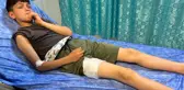 Başıboş köpeklerin saldırısına uğrayan küçük çocuk canını zor kurtardı