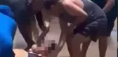 Teksas'ta dehşet verici köpek balığı saldırısı: Bir kadın, ciddi şekilde yaralandı